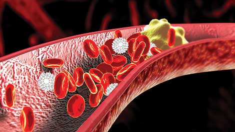 Cholesterol: Natural Solutions Better Than Statins